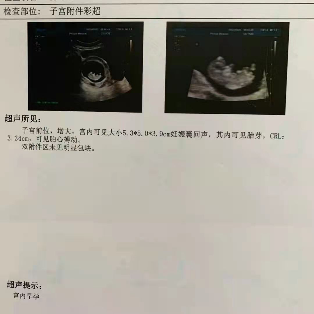 深圳妇产孕检报告